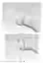 Fig. 10 - PARTIAL JOINT RESURFACING IMPLANT, INSTRUMENTATION AND METHOD