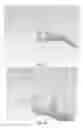 Fig. 11 - PARTIAL JOINT RESURFACING IMPLANT, INSTRUMENTATION AND METHOD