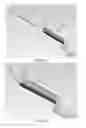 Fig. 13 - PARTIAL JOINT RESURFACING IMPLANT, INSTRUMENTATION AND METHOD