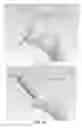 Fig. 14 - PARTIAL JOINT RESURFACING IMPLANT, INSTRUMENTATION AND METHOD