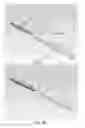 Fig. 15 - PARTIAL JOINT RESURFACING IMPLANT, INSTRUMENTATION AND METHOD