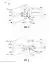 Fig. 02 - Cervical distraction method