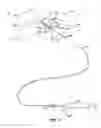 Fig. 03 - Cervical distraction method
