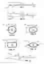 Fig. 05 - Cervical distraction method