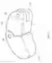 Fig. 35 - Inter-body implantation system and method
