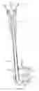 Fig. 63 - Inter-body implantation system and method