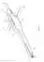 Fig. 20 - Inter-body implant