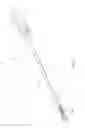Fig. 30 - Inter-body implant