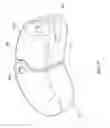 Fig. 35 - Inter-body implant