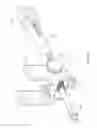 Fig. 68 - Inter-body implant