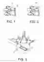 Fig. 02 - Apparatus and kit for distraction of tissue surfaces