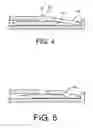 Fig. 03 - Apparatus and kit for distraction of tissue surfaces