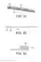 Fig. 10 - Apparatus and kit for distraction of tissue surfaces