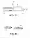 Fig. 14 - Apparatus and kit for distraction of tissue surfaces