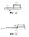Fig. 15 - Apparatus and kit for distraction of tissue surfaces