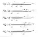 Fig. 16 - Apparatus and kit for distraction of tissue surfaces
