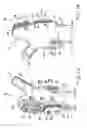 Fig. 07 - Methods and apparatuses for attaching tissue to orthopaedic implants