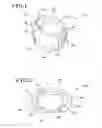 Fig. 02 - Tibial augments for use with knee joint prostheses