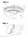 Fig. 03 - Acetabular cup assembly for multiple bearing materials