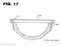 Fig. 10 - Acetabular cup assembly for multiple bearing materials