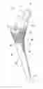 Fig. 01 - Hip stem prosthesis