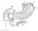 Fig. 01 - Obesity treatment and device