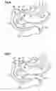 Fig. 05 - Obesity treatment and device