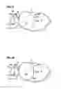 Fig. 10 - Obesity treatment and device