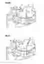 Fig. 14 - Obesity treatment and device