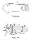 Fig. 05 - Spring orthotic device