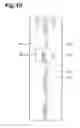 Fig. 11 - Object detection device