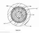 Fig. 04 - Pin puller