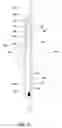 Fig. 07 - Apparatuses and methods for applying a strap around a bundle of objects