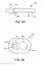 Fig. 05 - Washer with cooling passage for a turbine engine combustor
