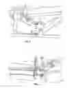 Fig. 04 - Profiling method and apparatus