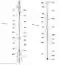 Fig. 01 - Convertible Trekking Paddle