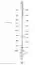 Fig. 02 - Convertible Trekking Paddle