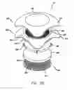 Fig. 03 - Temperature-retaining device