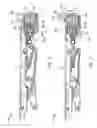 Fig. 09 - Security gate mechanism for a currency handling device