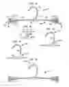 Fig. 06 - Micro-beam intimate apparel hanger