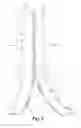Fig. 06 - APPARATUS AND METHODS FOR PROVIDING A RETRACTIBLE MAST