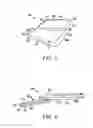 Fig. 04 - Method for implementing zoom functionality on a portable device with opposing touch sensitive surfaces