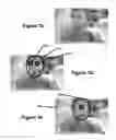 Fig. 08 - Perfecting the effect of flash within an image acquisition devices using face detection