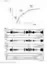 Fig. 06 - Hearing aid
