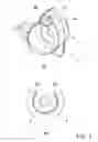 Fig. 04 - Hearing aid