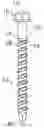 Fig. 01 - MASONRY ANCHOR