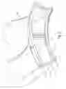 Fig. 03 - Seals for a turbine engine, and methods of assembling a turbine engine