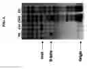 Fig. 02 - Methods of preparing tissues for xenotransplantation using α-galactosidases