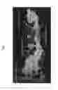 Fig. 07 - Chimeric flavivirus vectors