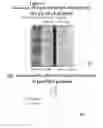 Fig. 07 - Protein capable of inhibiting anthrax toxin activity